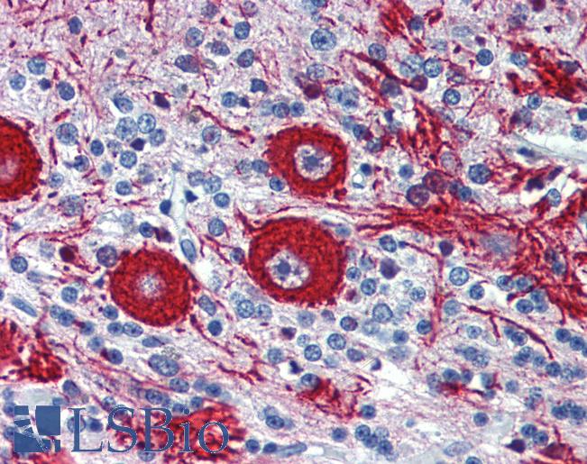 VEZF1 Antibody - Anti-VEZF1 antibody IHC of human brain, cerebellum. Immunohistochemistry of formalin-fixed, paraffin-embedded tissue after heat-induced antigen retrieval. Antibody concentration 5 ug/ml.  This image was taken for the unconjugated form of this product. Other forms have not been tested.