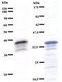 VEZF1 Antibody - Western blot of immunized recombinant protein using ZNF161 antibody. Left: ZNF161 staining. Right: Coomassie Blue staining of immunized recombinant protein.