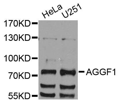 VG5Q / AGGF1 Antibody - Western blot blot of extract of various cells, using AGGF1 antibody.