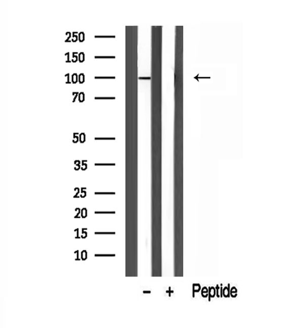 VG5Q / AGGF1 Antibody - Western blot analysis of extracts of mouse liver tissue using AGGF1 antibody.