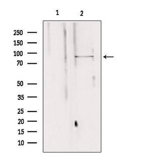 VG5Q / AGGF1 Antibody - Western blot analysis of extracts of 293 cells using AGGF1 antibody. Lane 1 was treated with the blocking peptide.