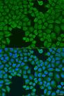 VG5Q / AGGF1 Antibody - Immunofluorescence analysis of U2OS cells using AGGF1 Polyclonal Antibody at dilution of 1:100.Blue: DAPI for nuclear staining.