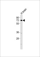 VGF Antibody - Anti-VGF Antibody at 1:1000 dilution + human brain lysates Lysates/proteins at 20 ug per lane. Secondary Goat Anti-Rabbit IgG, (H+L),Peroxidase conjugated at 1/10000 dilution Predicted band size : 67 kDa Blocking/Dilution buffer: 5% NFDM/TBST.