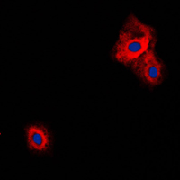 VGF Antibody - Immunofluorescent analysis of VGF staining in Raw264.7 cells. Formalin-fixed cells were permeabilized with 0.1% Triton X-100 in TBS for 5-10 minutes and blocked with 3% BSA-PBS for 30 minutes at room temperature. Cells were probed with the primary antibody in 3% BSA-PBS and incubated overnight at 4 C in a humidified chamber. Cells were washed with PBST and incubated with a DyLight 594-conjugated secondary antibody (red) in PBS at room temperature in the dark. DAPI was used to stain the cell nuclei (blue).