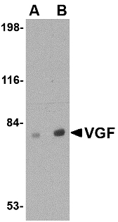VGF Antibody - Western blot of VGF in human brain tissue lysate with VGF antibody at (A) 0.5 and (B) 1 ug/ml.