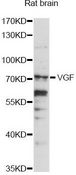 VGF Antibody - Western blot analysis of extracts of rat brain, using VGF antibody at 1:1000 dilution. The secondary antibody used was an HRP Goat Anti-Rabbit IgG (H+L) at 1:10000 dilution. Lysates were loaded 25ug per lane and 3% nonfat dry milk in TBST was used for blocking. An ECL Kit was used for detection and the exposure time was 90s.