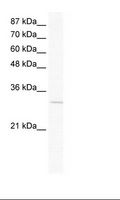 VGLL1 Antibody - Jurkat Cell Lysate.  This image was taken for the unconjugated form of this product. Other forms have not been tested.