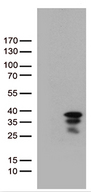 VGLL1 Antibody - HEK293T cells were transfected with the pCMV6-ENTRY control. (Left lane) or pCMV6-ENTRY VGLL1. (Right lane) cDNA for 48 hrs and lysed