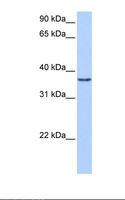 VGLL2 Antibody - Fetal heart cell lysate. Antibody concentration: 0.5 ug/ml. Gel concentration: 12%.  This image was taken for the unconjugated form of this product. Other forms have not been tested.