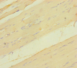 VGLL2 Antibody - Immunohistochemistry of paraffin-embedded human skeletal muscle tissue using VGLL2 Antibody at dilution of 1:100