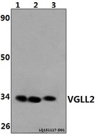 VGLL2 Antibody - Western blot of VGLL2 polyclonal antibody at 1:500 dilution. Lane 1: The Heart tissue lysate of Rat(40 ug). Lane 2: The Heart tissue lysate of Mouse(40 ug). Lane 3: HeLa whole cell lysate (40 ug).