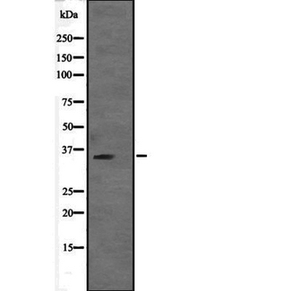 VGLL2 Antibody - Western blot analysis of VGLL2 expression in VGLL2 transfected 293T cells lysate. The lane on the left is treated with the antigen-specific peptide.