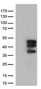 VGLL3 Antibody - HEK293T cells were transfected with the pCMV6-ENTRY control. (Left lane) or pCMV6-ENTRY VGLL3. (Right lane) cDNA for 48 hrs and lysed. Equivalent amounts of cell lysates. (5 ug per lane) were separated by SDS-PAGE and immunoblotted with anti-VGLL3. (1:500)