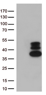 VGLL3 Antibody - HEK293T cells were transfected with the pCMV6-ENTRY control. (Left lane) or pCMV6-ENTRY VGLL3. (Right lane) cDNA for 48 hrs and lysed. Equivalent amounts of cell lysates. (5 ug per lane) were separated by SDS-PAGE and immunoblotted with anti-VGLL3. (1:500)
