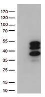 VGLL3 Antibody - HEK293T cells were transfected with the pCMV6-ENTRY control. (Left lane) or pCMV6-ENTRY VGLL3. (Right lane) cDNA for 48 hrs and lysed. Equivalent amounts of cell lysates. (5 ug per lane) were separated by SDS-PAGE and immunoblotted with anti-VGLL3. (1:500)