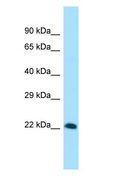 VGLL4 Antibody - VGLL4 antibody Western Blot of HT1080 Whole Cell lysates. Antibody Dilution: 1.0 ug/ml. VGLL4 is strongly supported by BioGPS gene expression data to be expressed in Human HT1080 cells. Antibody dilution: 1 ug/ml.  This image was taken for the unconjugated form of this product. Other forms have not been tested.