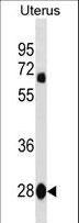 VGLL4 Antibody - VGLL4 Antibody western blot of human Uterus tissue lysates (35 ug/lane). The VGLL4 antibody detected the VGLL4 protein (arrow).