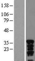 VGLL4 Protein - Western validation with an anti-DDK antibody * L: Control HEK293 lysate R: Over-expression lysate