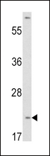 VHL / Von Hippel Lindau Antibody - Western blot of VHL antibody in HepG2 cell line lysates (35 ug/lane). VHL (arrow) was detected using the purified antibody.