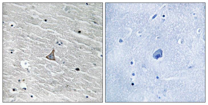 VHL / Von Hippel Lindau Antibody - Peptide - + Immunohistochemistry analysis of paraffin-embedded human brain tissue using VHL antibody.