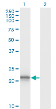 VHL / Von Hippel Lindau Antibody - Western Blot analysis of VHL expression in transfected 293T cell line by VHL monoclonal antibody (M01), clone 1G12.Lane 1: VHL transfected lysate(19.7 KDa).Lane 2: Non-transfected lysate.