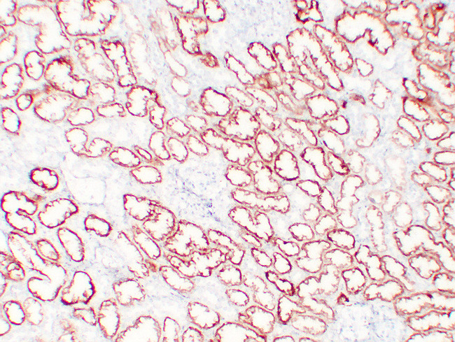 VHL / Von Hippel Lindau Antibody - Kidney 1