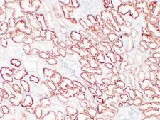 VHL / Von Hippel Lindau Antibody - Kidney 1