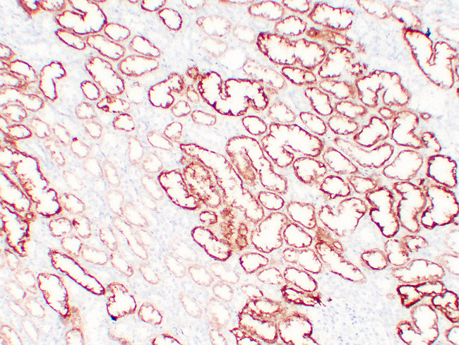 VHL / Von Hippel Lindau Antibody - Kidney 3
