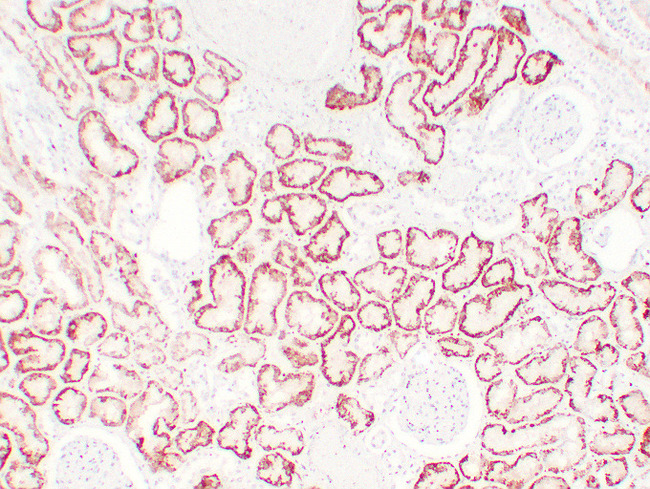 VHL / Von Hippel Lindau Antibody - Kidney 4
