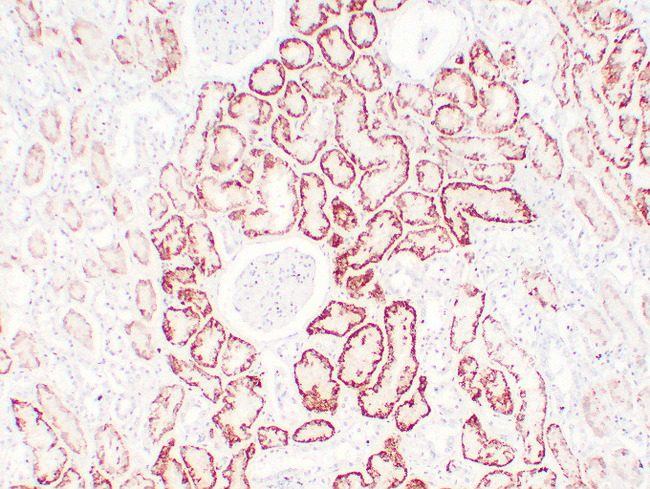 VHL / Von Hippel Lindau Antibody - Kidney 5
