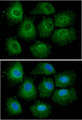 VHL / Von Hippel Lindau Antibody - ICC/IF analysis of VHL in Hep3B. The cell was stained with VHL antibody (1:100).The secondary antibody (green) was used Alexa Fluor 488. DAPI was stained the cell nucleus (blue).