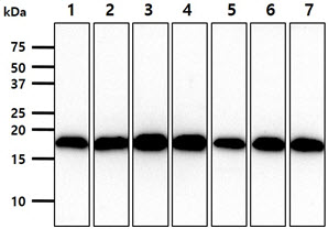 VHL / Von Hippel Lindau Antibody - The cell lysates (40ug) were resolved by SDS-PAGE, transferred to PVDF membrane and probed with anti-human VHL antibody (1:1000). Proteins were visualized using a goat anti-mouse secondary antibody conjugated to HRP and an ECL detection system. Lane 1.: HepG2 cell lysate Lane 2.: HeLa cell lysate Lane 3.: Raji cell lysate Lane 4.: Jurkat cell lysate Lane 5.: A549 cell lysate Lane 6.: MCF7 cell lysate Lane 7.: PC3 cell lysate