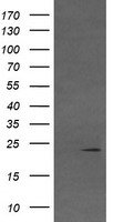 VHL / Von Hippel Lindau Antibody - HEK293T cells were transfected with the pCMV6-ENTRY control (Left lane) or pCMV6-ENTRY VHL (Right lane) cDNA for 48 hrs and lysed. Equivalent amounts of cell lysates (5 ug per lane) were separated by SDS-PAGE and immunoblotted with anti-VHL.