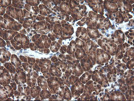 VHL / Von Hippel Lindau Antibody - IHC of paraffin-embedded Human pancreas tissue using anti-VHL mouse monoclonal antibody.