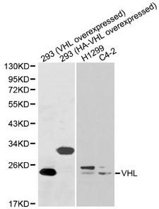 VHL / Von Hippel Lindau Antibody - Western blot of VHL pAb in extracts from 293(VHL overexpressed), 293(HA-VHL overexpressed), H1299 and C4-2 cells.