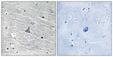 VHL / Von Hippel Lindau Antibody - Immunohistochemistry analysis of paraffin-embedded human brain tissue, using VHL Antibody. The picture on the right is blocked with the synthesized peptide.