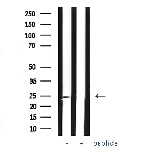VHL / Von Hippel Lindau Antibody - Western blot analysis of VHL expression in whole cells lysates. The lane on the left is treated with the antigen-specific peptide.