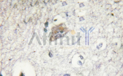 VHL / Von Hippel Lindau Antibody - 1:200 staining mouse kidney tissue by IHC-P.