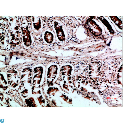 VHL / Von Hippel Lindau Antibody - Immunohistochemical analysis of paraffin-embedded human-colon, antibody was diluted at 1:200.