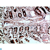 VHL / Von Hippel Lindau Antibody - Immunohistochemical analysis of paraffin-embedded human-colon, antibody was diluted at 1:200.