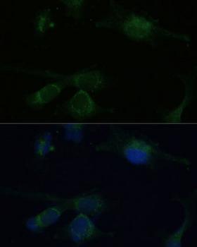 VHL / Von Hippel Lindau Antibody - Immunofluorescence analysis of U-251MG cells using VHL Polyclonal Antibody at dilution of 1:100 (40x lens).Blue: DAPI for nuclear staining.