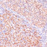 VHL / Von Hippel Lindau Antibody - Immunohistochemistry of paraffin-embedded Rat ovary using VHL Polyclonal Antibody at dilution of 1:200 (40x lens).