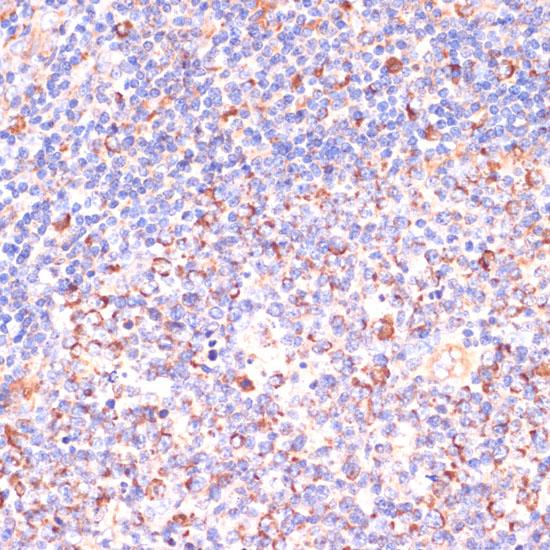 VHL / Von Hippel Lindau Antibody - Immunohistochemistry of paraffin-embedded Human tonsil using VHL Polyclonal Antibody at dilution of 1:200 (40x lens).