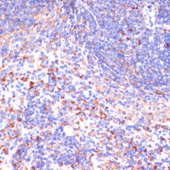 VHL / Von Hippel Lindau Antibody - Immunohistochemistry of paraffin-embedded Mouse spleen using VHL Polyclonal Antibody at dilution of 1:200 (40x lens).