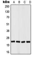 VHL / Von Hippel Lindau Antibody - Western blot analysis of Von Hippel Lindau expression in HepG2 (A); HEK293T (B); A549 (C); rat brain (D) whole cell lysates.