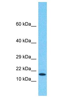 VHLL Antibody - VHLL antibody Western Blot of HeLa. Antibody dilution: 1 ug/ml.  This image was taken for the unconjugated form of this product. Other forms have not been tested.