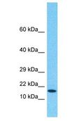 VHLL Antibody - VHLL antibody Western Blot of HeLa. Antibody dilution: 1 ug/ml.  This image was taken for the unconjugated form of this product. Other forms have not been tested.