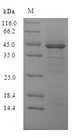 ompK Protein - (Tris-Glycine gel) Discontinuous SDS-PAGE (reduced) with 5% enrichment gel and 15% separation gel.