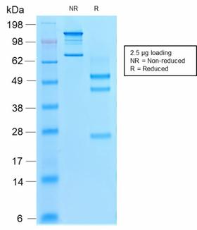 VIL1 / Villin Antibody - SDS-PAGE Analysis Purified Villin Mouse Recombinant Monoclonal Antibody (rVIL1/1325). Confirmation of Purity and Integrity of Antibody.
