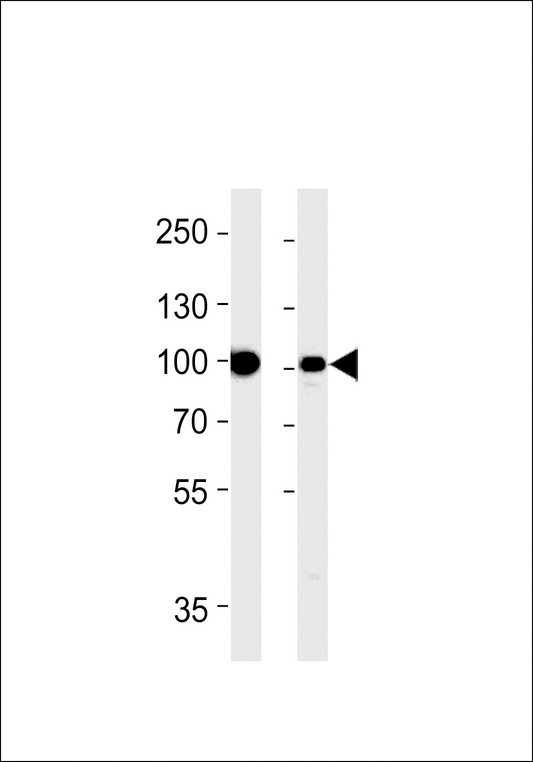 VIL1 / Villin Antibody - Villin-1 Antibody western blot of HT29 cell line and mouse kidney tissue lysates (35 ug/lane). The Villin-1 antibody detected the Villin-1 protein (arrow).